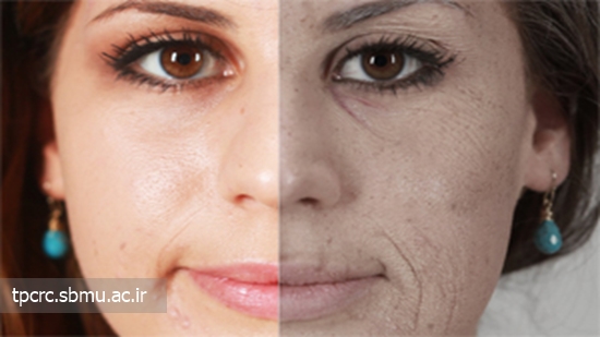 چين و چروك پوست 